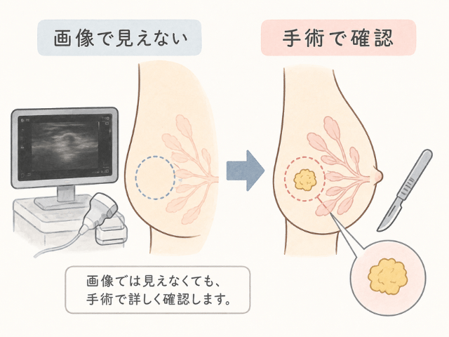画像検査と手術後の確認の違いを、乳房の図と矢印で示した医療説明イラスト